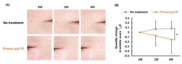 Figure 4. Improvement of wrinkles (A) Representative photographs of wrinkles around the eyes after application of PrimeLipid PI lotion vs. no treatment after 0, 2, and 4 weeks. (B) Changes in wrinkle score after 0, 2, and 4 weeks of application of PrimeLipid PI (●) and after no treatment (O). Mean ± SD (n=18).