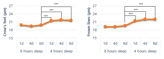 Fig 2. Crow’s feet and frown lines were significantly increased 1d after sleeping for 4h versus the 8h sleep period.