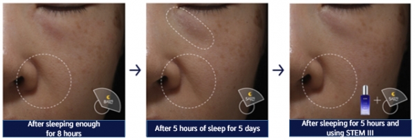 Anti-aging effect of IOPE STEM III Ampoule. The study enrolled 32 Korean female subjects in their 40s who normally had no problem with sleeping.