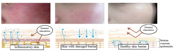 Fig. 1   Skin barrier in different states